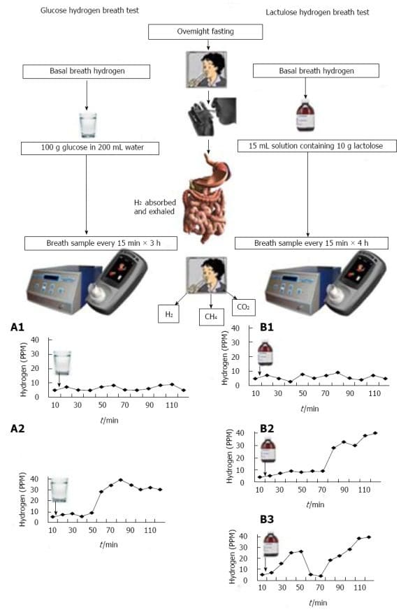 Figure 1 Outline of Principle of Method and Interpretation of Glucose and Lactulose Hydrogen Breath Tests Image 2