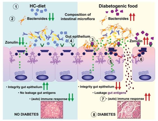 ചിത്രം 2, T1D പാത്തോജെനിസിസ് ഇമേജ് 2-ൽ ഗ്ലൂട്ടന്റെ പ്രവർത്തനത്തിന്റെ അനുമാനിക്കപ്പെട്ട സംവിധാനം