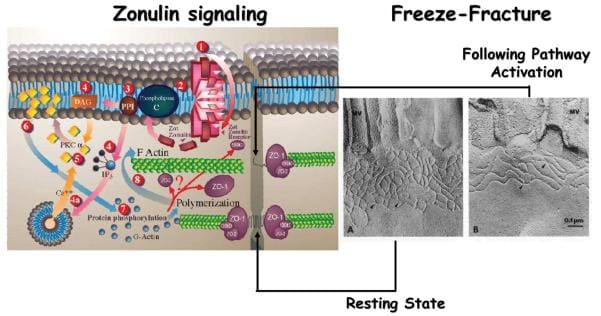 Figure 3 Proposed Zonulin Intracellular Signaling Leading to the Opening of the Intestinal TJs Image 2