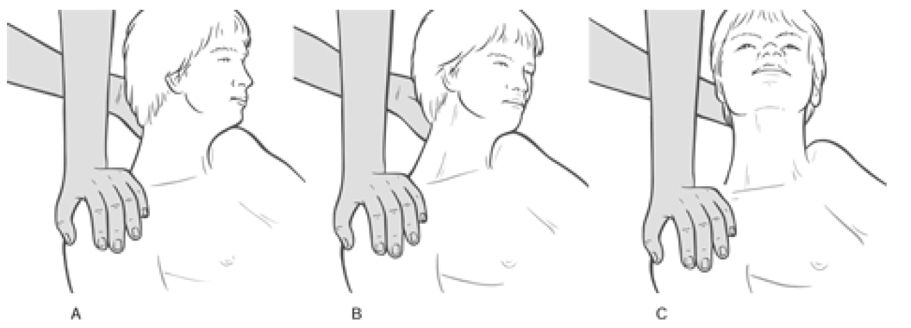 Figure 4 32 MET Treatment of Right Side Upper Trapezius Muscle Image 3