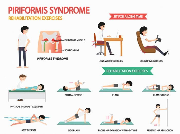 https://personalinjurydoctorgroup.com/wp-content/uploads/2018/01/piriformis-syndrome-rehabilitation-exercises.jpg