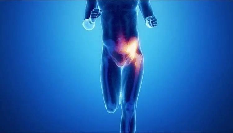 Ultrasound-Guided PRP for Hip Impingement Explained