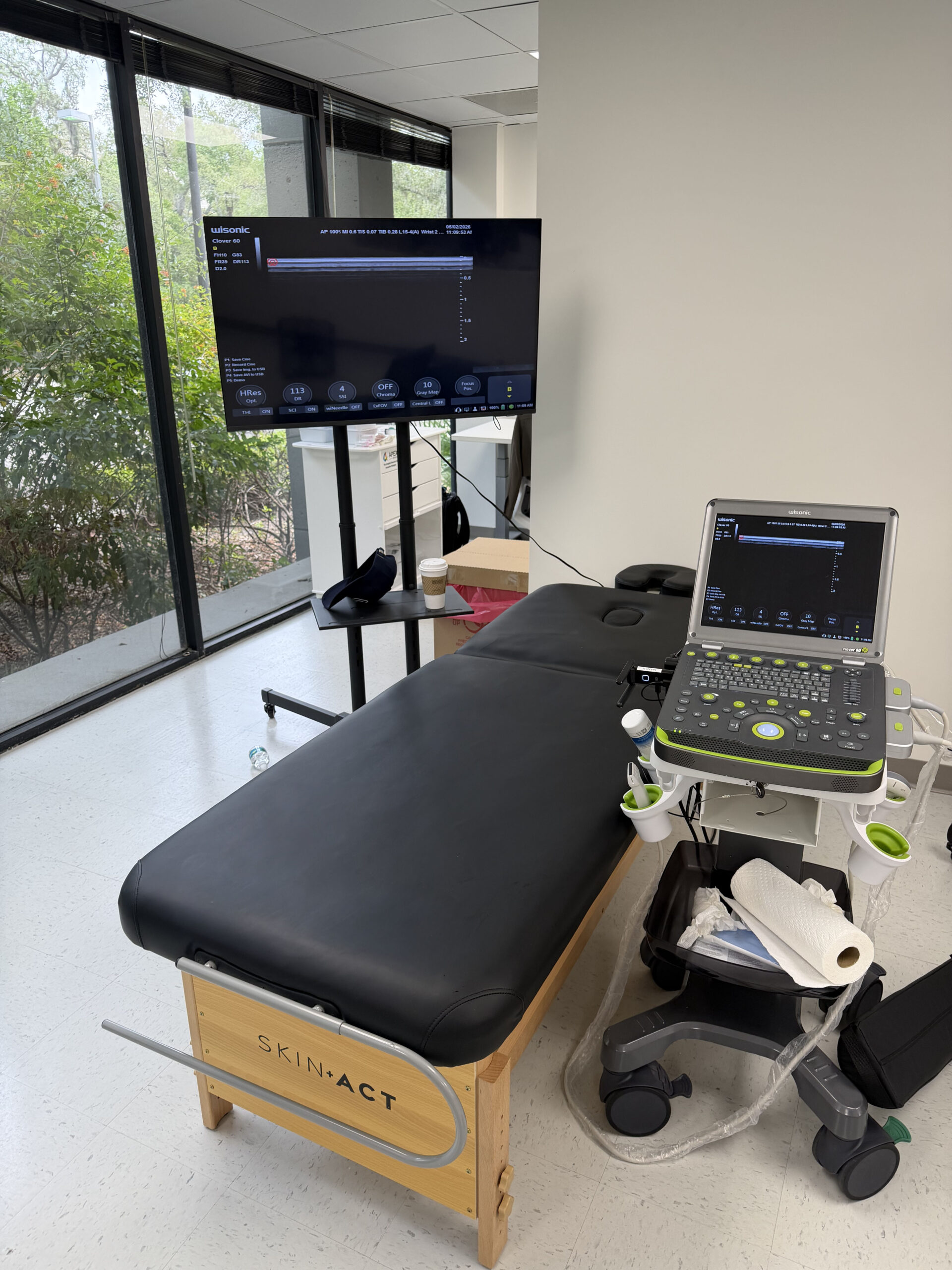 Ultrasound-Guided PRP for Hip Impingement Explained